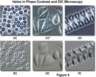 Differential Interference Contrast - Comparison of Phase Contrast and